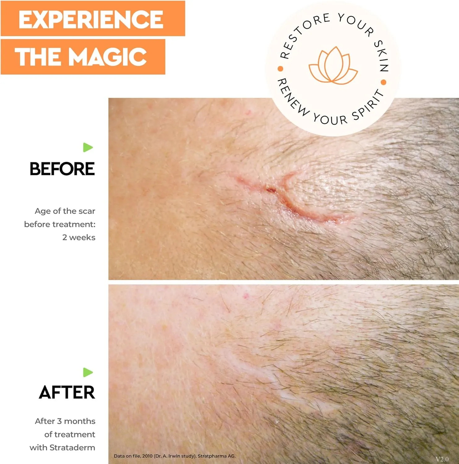 Strataderm Professional Scar Therapy Gel | Old and New Scars from General Surgery, Trauma, Wounds, Burns, Bites, Acne & Skin Disease | Reduces Redness, Discoloration, Discomfort & Itch | 5g (0.17oz)